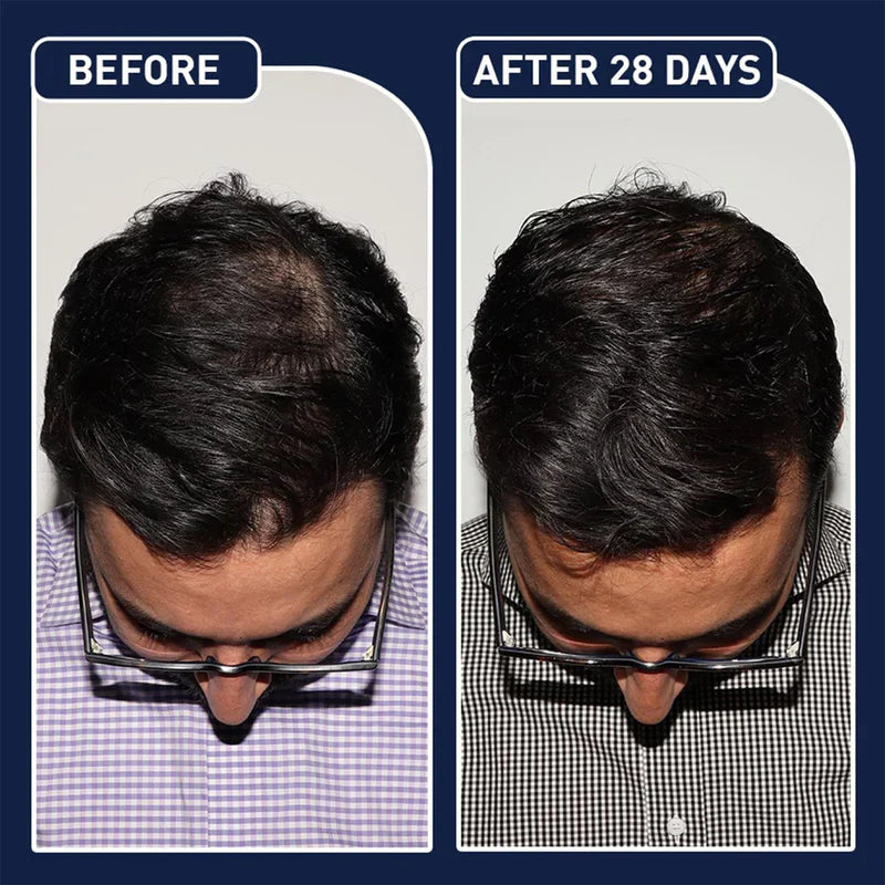Hair Growth Spray PLUS
